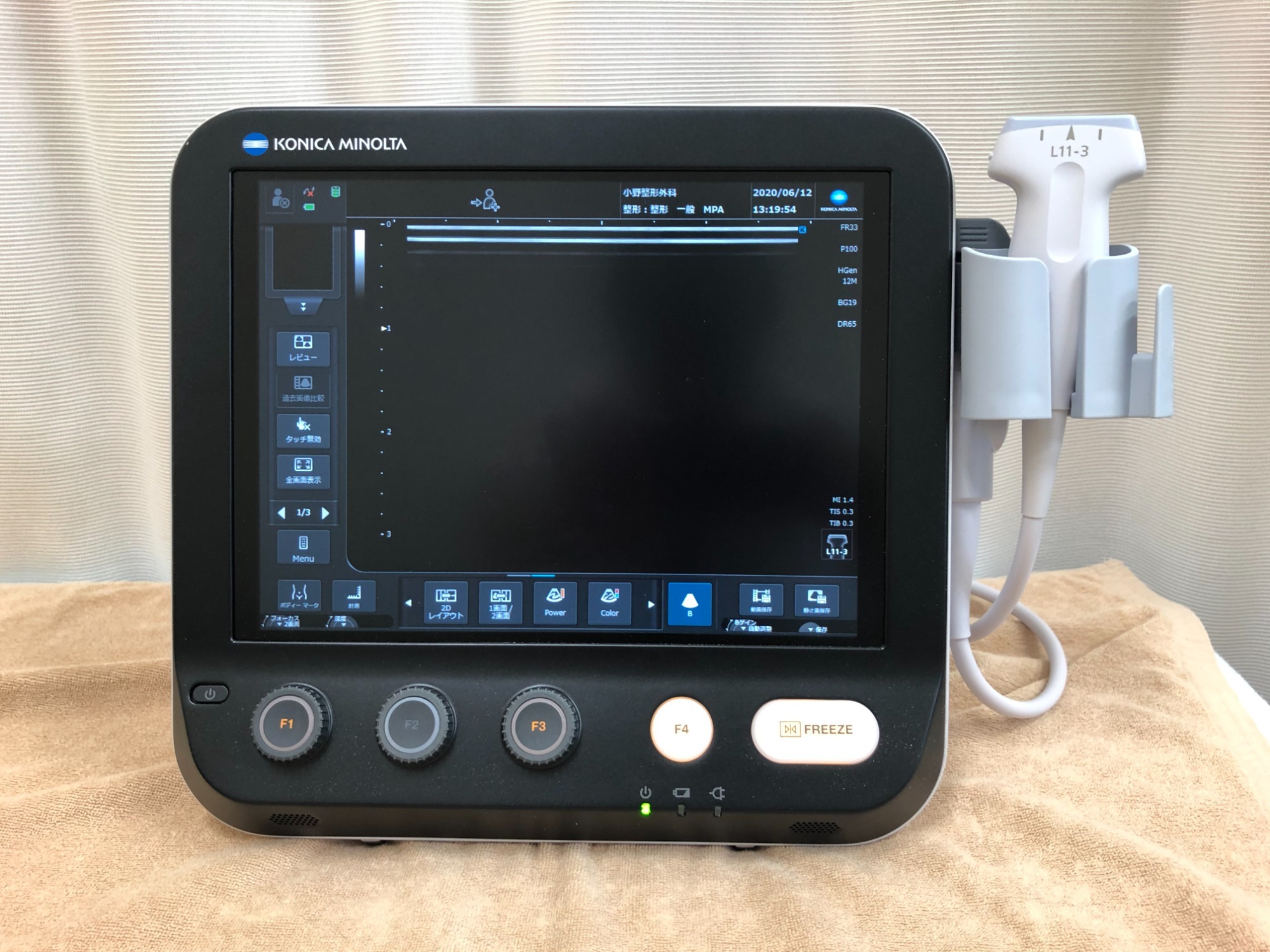 小野整形外科、超音波診断装置